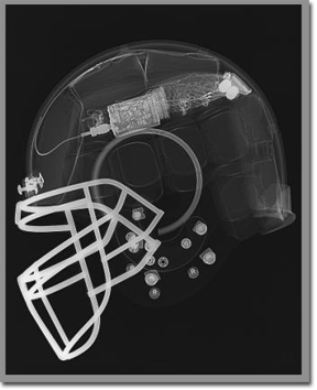 X Ray of HIT System Helmet